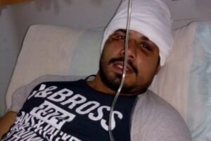 Cañuelas, la Polícia le provocó un accidente grave a Marcos Barrera.