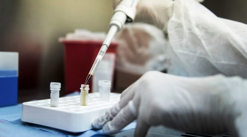 COVID-19 del inicio  de la pandemia son  4.606 los fallecidos y 246.499 los contagiados.