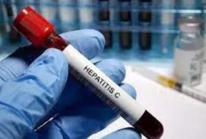 Hepatitis b