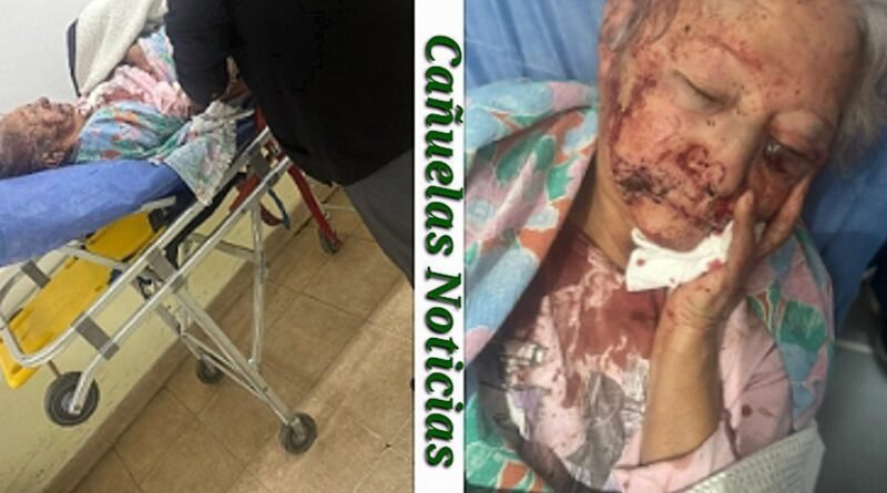 Cañuelas -  Le reventaron el ojo a patadas: a una abuela de 80 años brutalmente golpeada con caños.